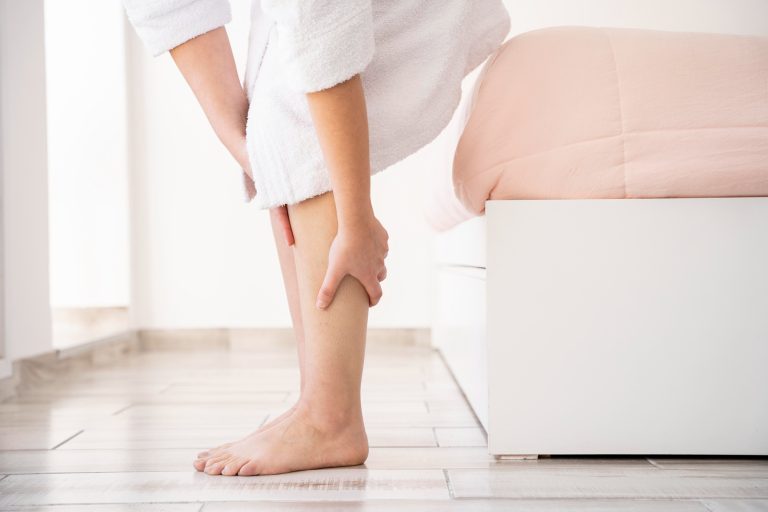 Varicose Veins: When Are They More Than Just a Cosmetic Issue?