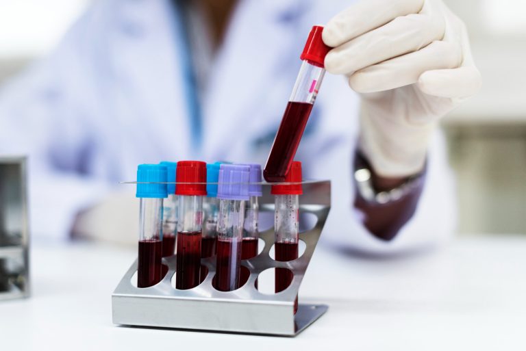 What blood tests you should get every year