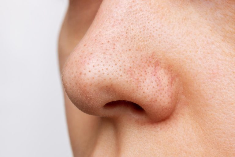 Why pores cannot open or close