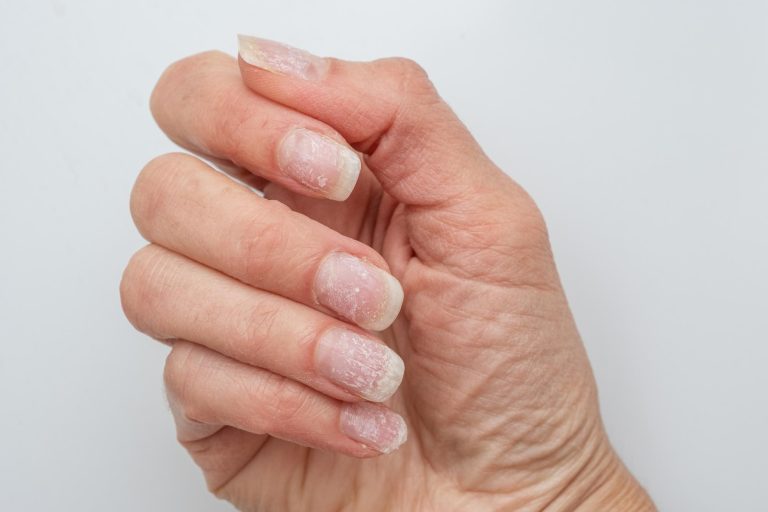 Why Do Our Nails Break More Easily Sometimes?