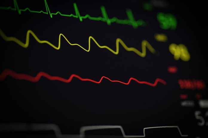 EEG monitoring screen in a clinical setting